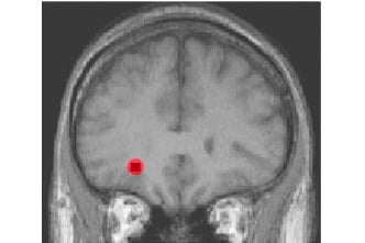 How do you use your brain during meditation?