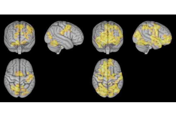 New study reveals the core meditation areas in the brain