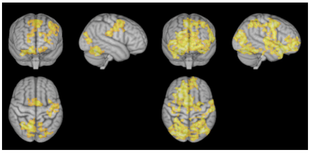 Brains acem nondirective